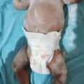 commented item thumbnail