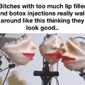 Lip filler