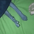 commented item thumbnail